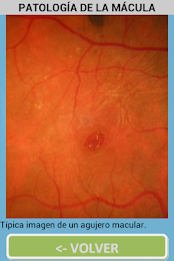 ophthalmology poster 16