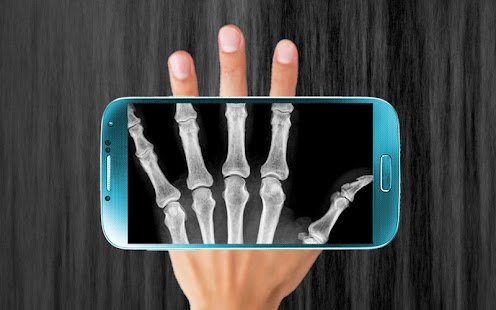How to download Xray Hand Scanner Prank 1.0 apk for bluestacks