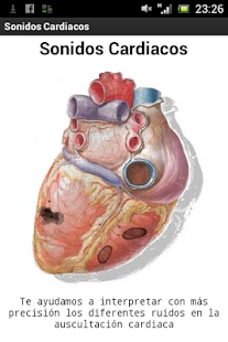 Sonidos Cardiacos Demostración