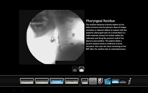 Swallowing Residue Screenshots 3