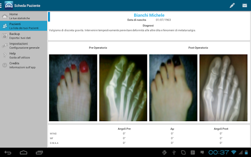 【免費健康App】HalluxValgus Free-APP點子