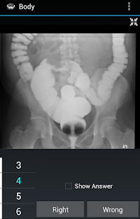 How to mod Radiology Flashcards: Free 1.4 unlimited apk for laptop