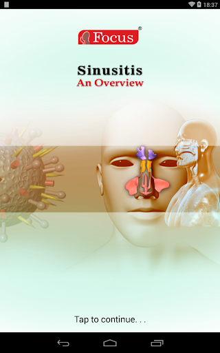 Sinusitis