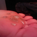 Get Rid Of Warts logo
