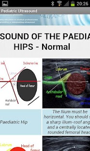 Pediatric Ultrasound Screenshots 3