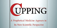 Cupping APK