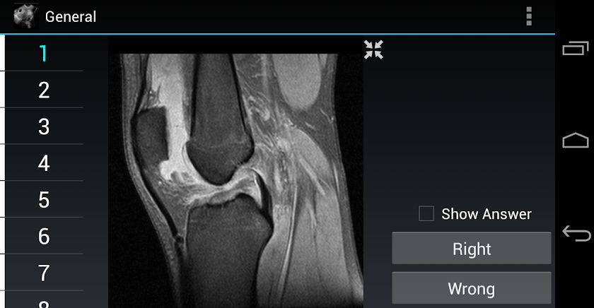 Radiology Flashcards: General Screen 1