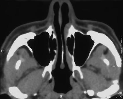 Xray_2