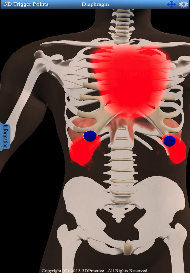 3D Trigger Points Screen 1