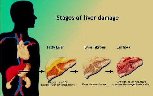 Download Liver Diet APK for Android