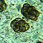 Dictydiaethalium plumbeum ?! spores