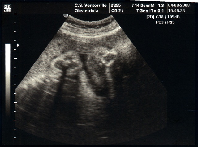 [Ecografía_32s001[2].jpg]