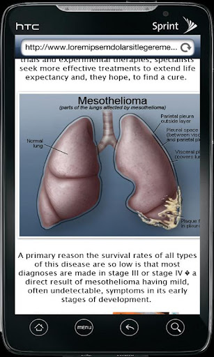 What Is Mesothelioma