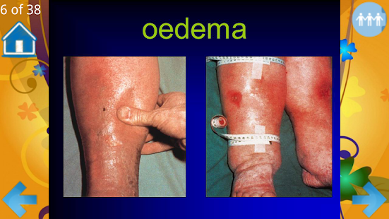 Examination of the heart Screenshots 0