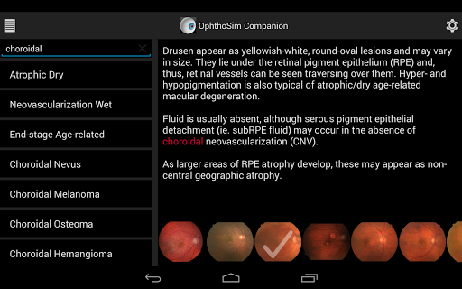 【免費醫療App】OphthoSim Companion-APP點子