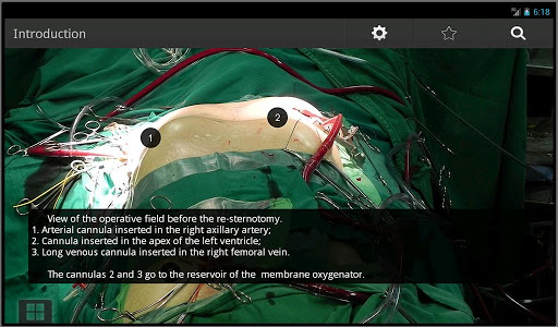 【免費醫療App】Aortic Surgery-APP點子