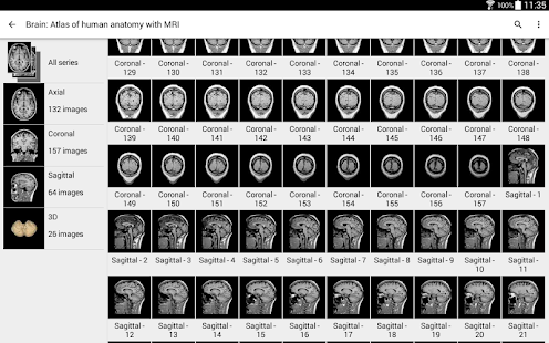 IMAIOS e-Anatomy