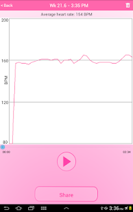 Fetal Doppler UnbornHeart - screenshot thumbnail