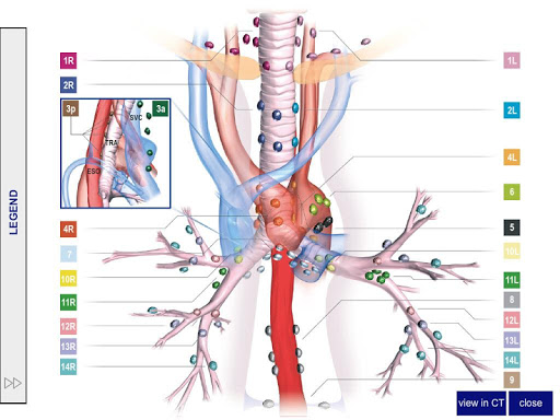 【免費醫療App】Lung Cancer Staging Table-APP點子