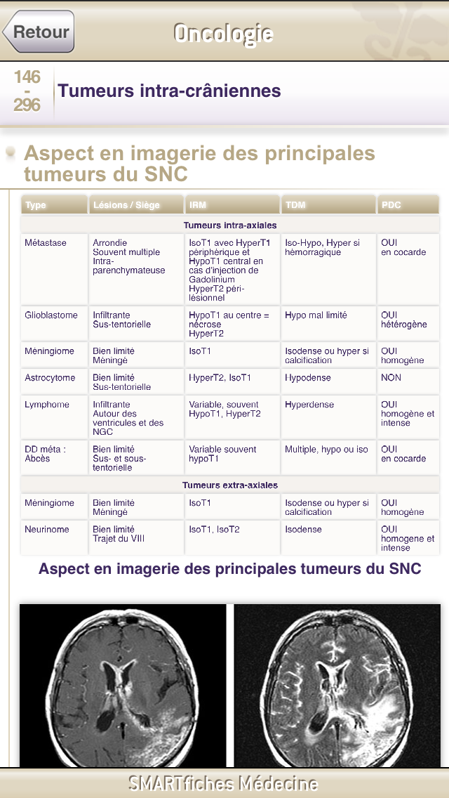 SMARTfiches Oncologie Screen 2