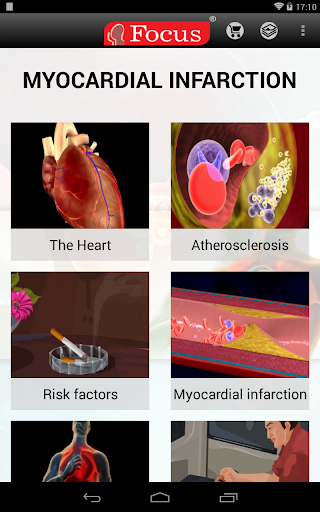 免費下載醫療APP|Myocardial infarction app開箱文|APP開箱王