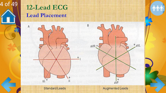 Basic ECG Interpretation Screenshots 1