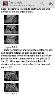 Download Atlas of Ultrasound Anesthesia APK
