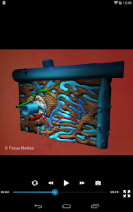 Dyslipidemia- An Overview Screenshots 9