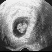 Obstetricia en preguntas