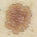 Skin Cancer Image Viewer logo