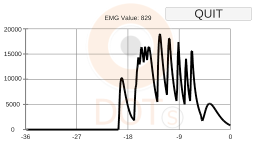 Dotri EMG Graph