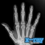 Cover Image of Скачать X-Ray Scanner 1.7.5 APK