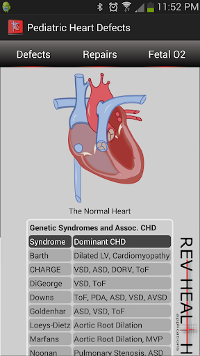 Heart Defects