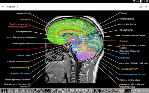 IMAIOS e-Anatomy