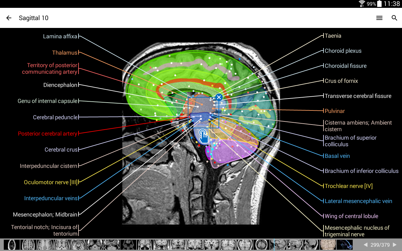 e-Anatomy – Android-Apps auf Google Play
