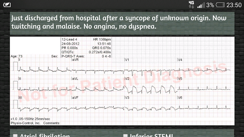ECG Quiz Screen 3