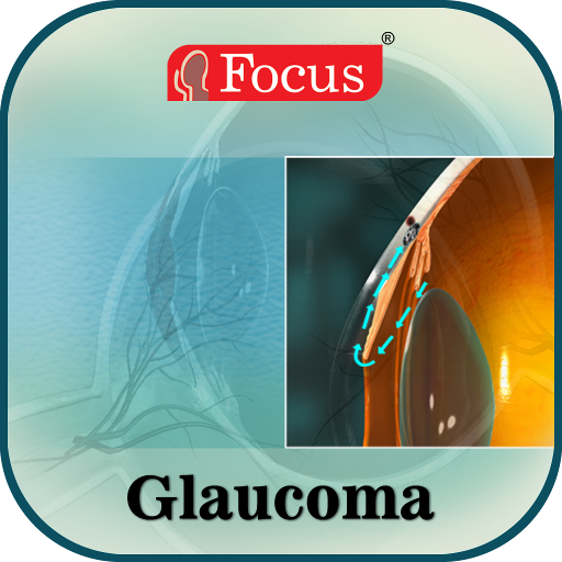 Glaucoma-An Overview 醫療 App LOGO-APP開箱王