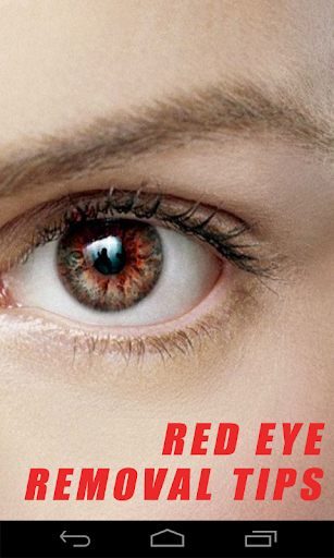 Red Eye Removal Tips