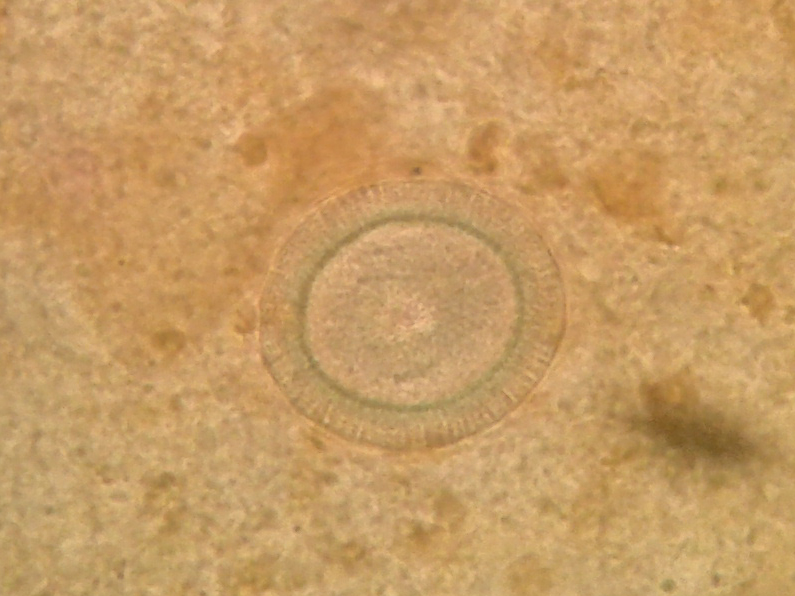 Pork Tapeworm [Embryonated Eggs]