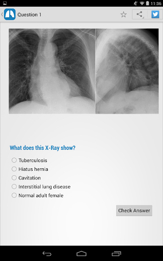 【免費醫療App】Chest X-Ray Training-APP點子