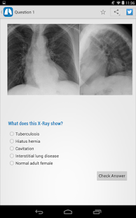 免費下載醫療APP|Chest X-Ray Training app開箱文|APP開箱王