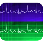 Electrocardiogram Apk