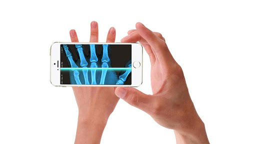 Xray Scan Pro