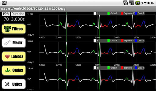 【免費醫療App】AndroidECG-APP點子