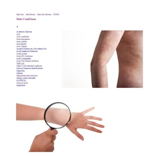 Skin Conditions and Diseases