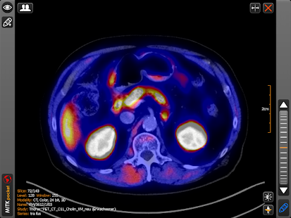 MITK pocket - DICOM Viewer