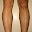 Home Laser&sol; IPL Hair Removal Download on Windows