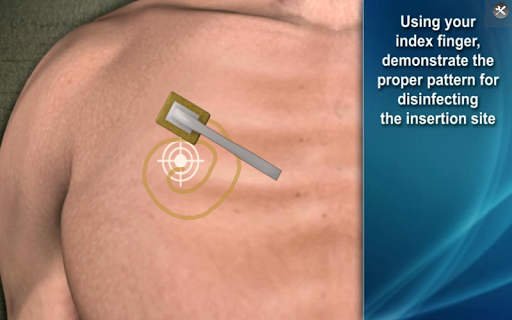 【免費醫療App】Medrills: NCD for Pneumothorax-APP點子